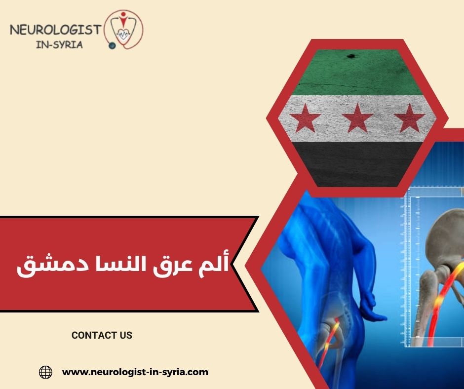 ألم عرق النسا دمشق