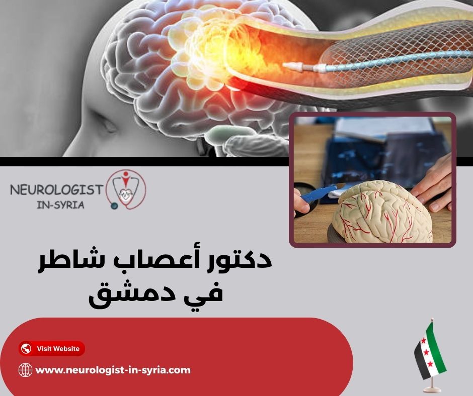 دكتور أعصاب شاطر في دمشق؟
