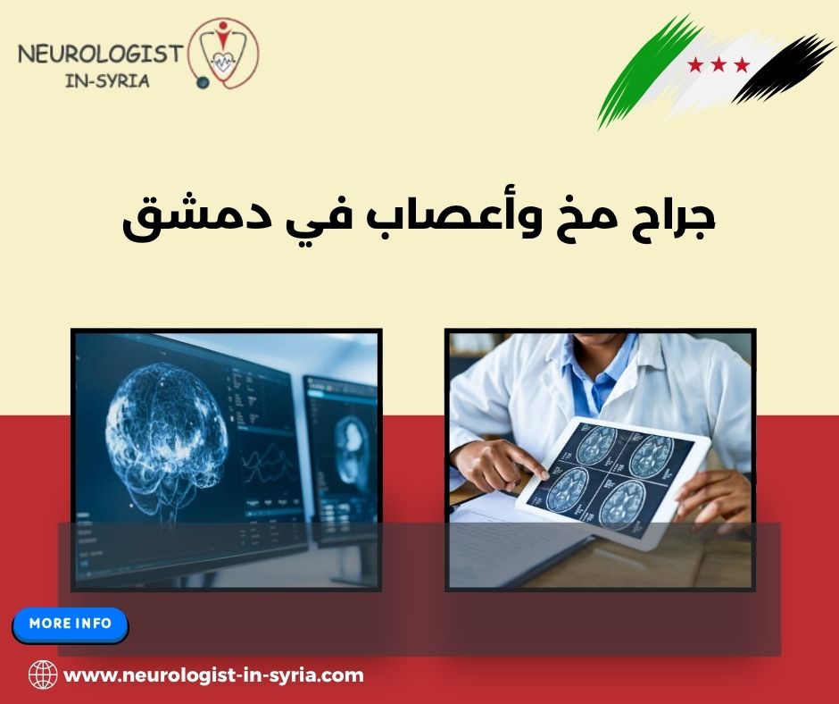 جراح مخ وأعصاب في دمشق