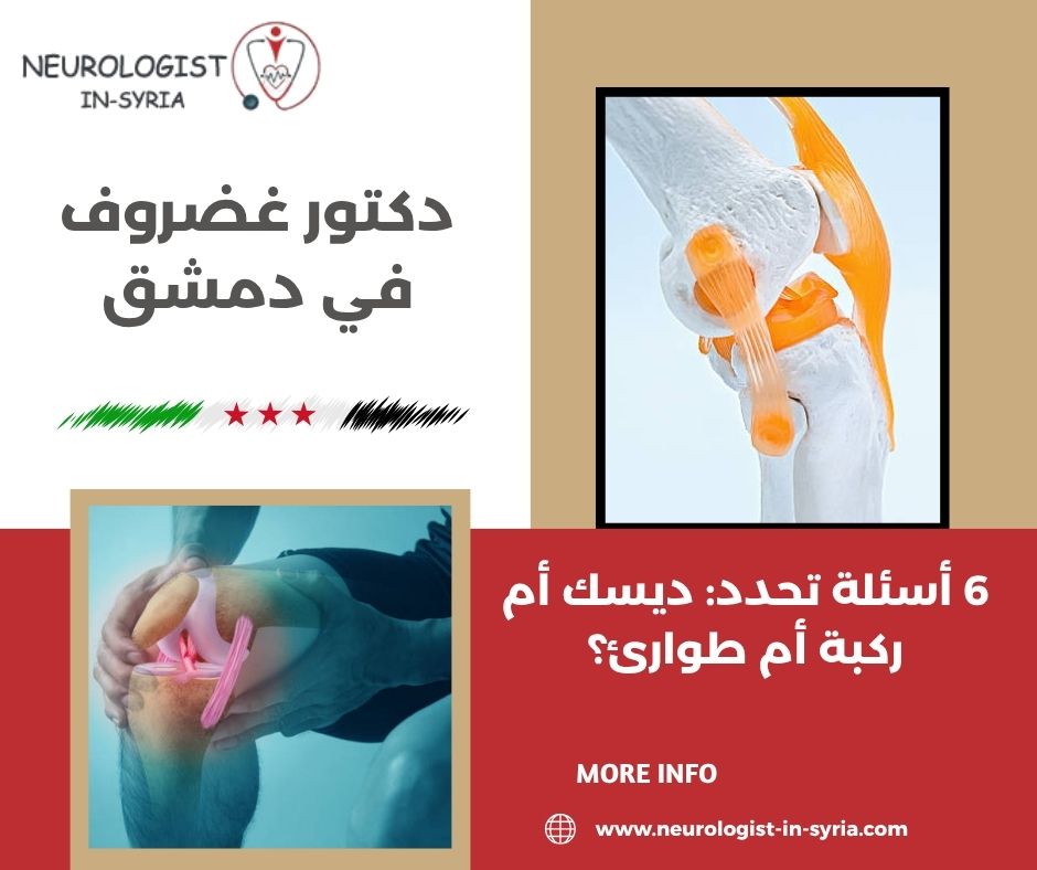 دكتور غضروف في دمشق